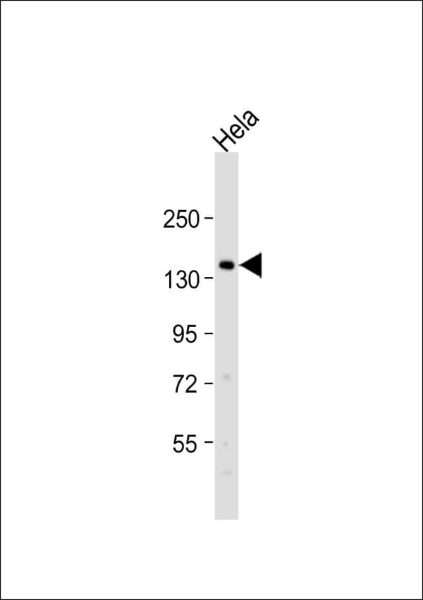 Polyclonal Rabbit anti-Human INPPL1 / SHIP2 Antibody (aa357-406, WB)