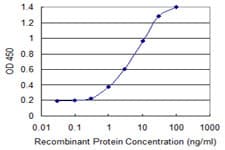 APCS / Serum Amyloid P / SAP Antibody (clone 4E8)
