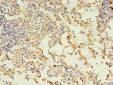 Polyclonal Rabbit anti-Human ADAM10 Antibody (IHC)