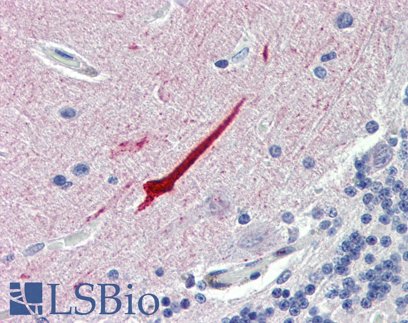 Polyclonal Rabbit anti-Human SEPT11 / Septin 11 Antibody (N-Terminus, IHC, WB)