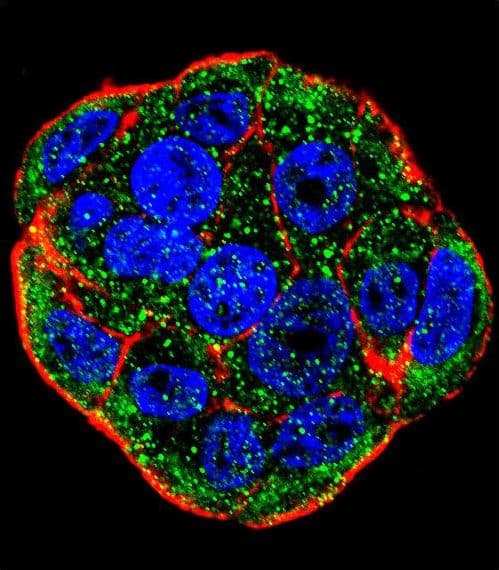 Polyclonal Rabbit anti-Human FGF1 / Acidic FGF Antibody (aa5-30, IHC, IF, WB)