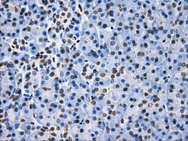LOX / Lysyl Oxidase Antibody (clone OTI8G5)
