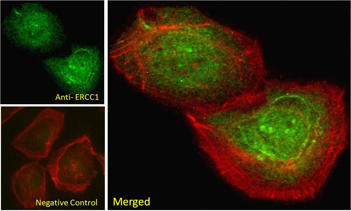 IHC-plus™ ERCC1 Antibody (aa172-184)