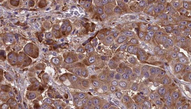 CCR2 Antibody