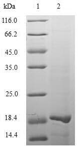 Human UL49 Protein (Recombinant 6His, N-terminus)