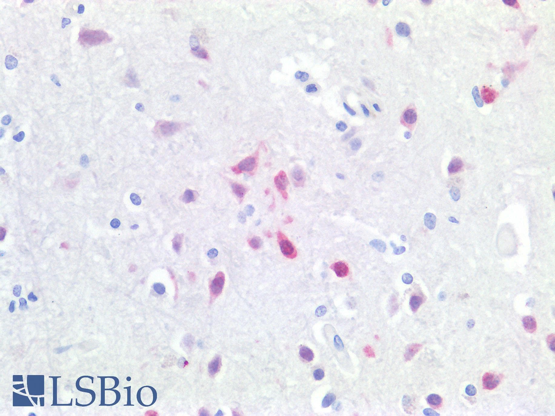 PathPlus™ Polyclonal Rabbit anti-Human RBFOX3 / NEUN Antibody (IHC, IF, WB)