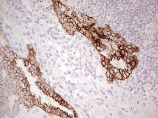 ABCB1 / MDR1 / P Glycoprotein Antibody (aa995-1280, clone OTI10H3, Carrier-free)