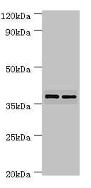 MAP2K3 / MEK3 / MKK3 Antibody (aa1-170)