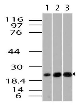 Monoclonal Mouse anti-Human NKIRAS1 Antibody (WB)