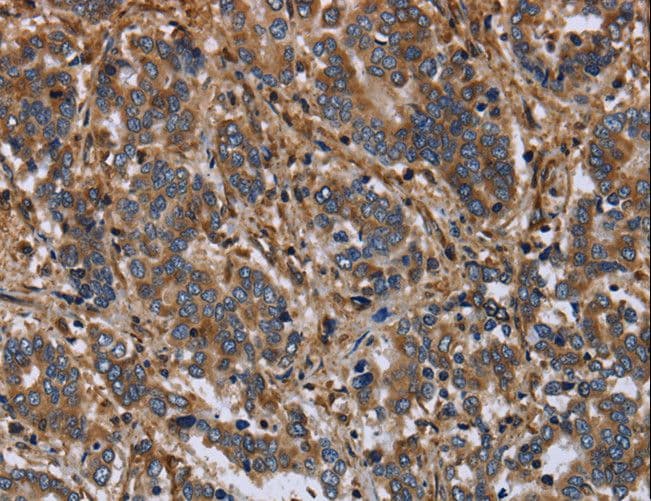 Polyclonal Rabbit anti-Human FLNA / Filamin A Antibody (IHC, WB)