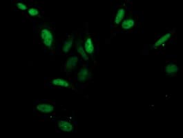 CDK2 Antibody (clone OTI2A5)