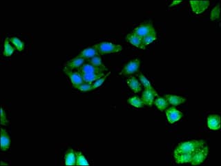 DIAPH3 / MDIA2 Antibody