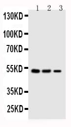 SERPINA4 / Kallistatin Antibody (aa384-401)