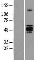 Human GSK3A / GSK3 Alpha Protein (Over-Expression Lysate Myc-DDK (Flag))