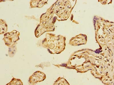 ABHD2 Antibody