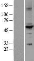 CYP2C9 / Cytochrome P450 2C9 Protein (Over-Expression Lysate Myc-DDK (Flag))