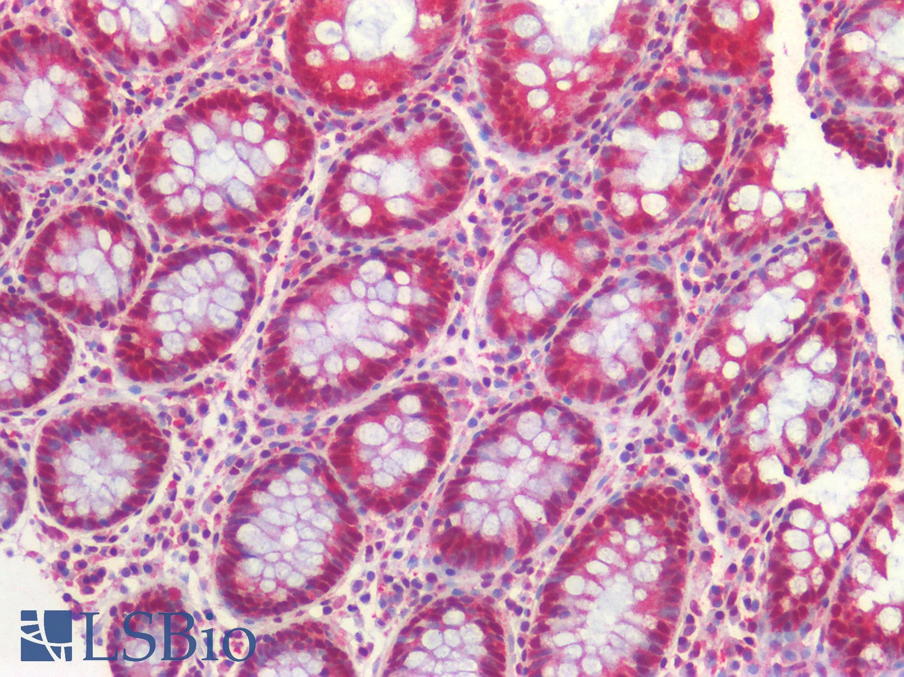 PathPlus™ Monoclonal Mouse anti-Human FOXP1 Antibody (clone JC12, IHC, WB)