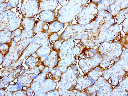 HP / Haptoglobin Antibody (clone UMAB10)