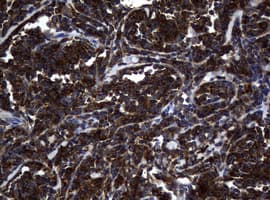 NME1 / NM23 Antibody (clone OTI24A2)