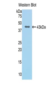 Polyclonal Rabbit anti-Rat CFB / Complement Factor B Antibody (PE, aa34-159, WB)