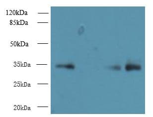 IHC-plus™ RCD1 / RQCD1 Antibody