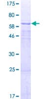 Human AADACL2 Protein (Recombinant GST)