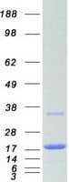 Human UBE2N / UBC13 Protein (Recombinant Myc-DDK (Flag))