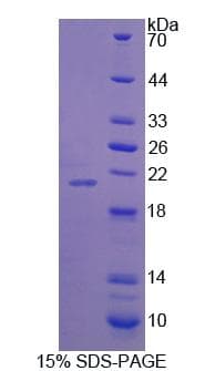 Human SYNPO / Synaptopodin Protein (Recombinant His, N-Terminal)