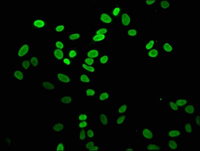 Polyclonal Rabbit anti-Human H2AFZ / H2A.z Antibody (IF)