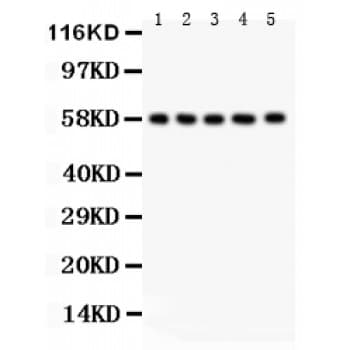 AGFG1 Antibody (aa5-28)