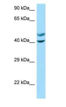 CAMK1 / CAMKI Antibody (aa21-70)