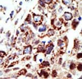 STAM1 / STAM Antibody (aa326-356)
