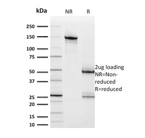 ERBB2 / HER2 Antibody (clone ERBB2/2453)