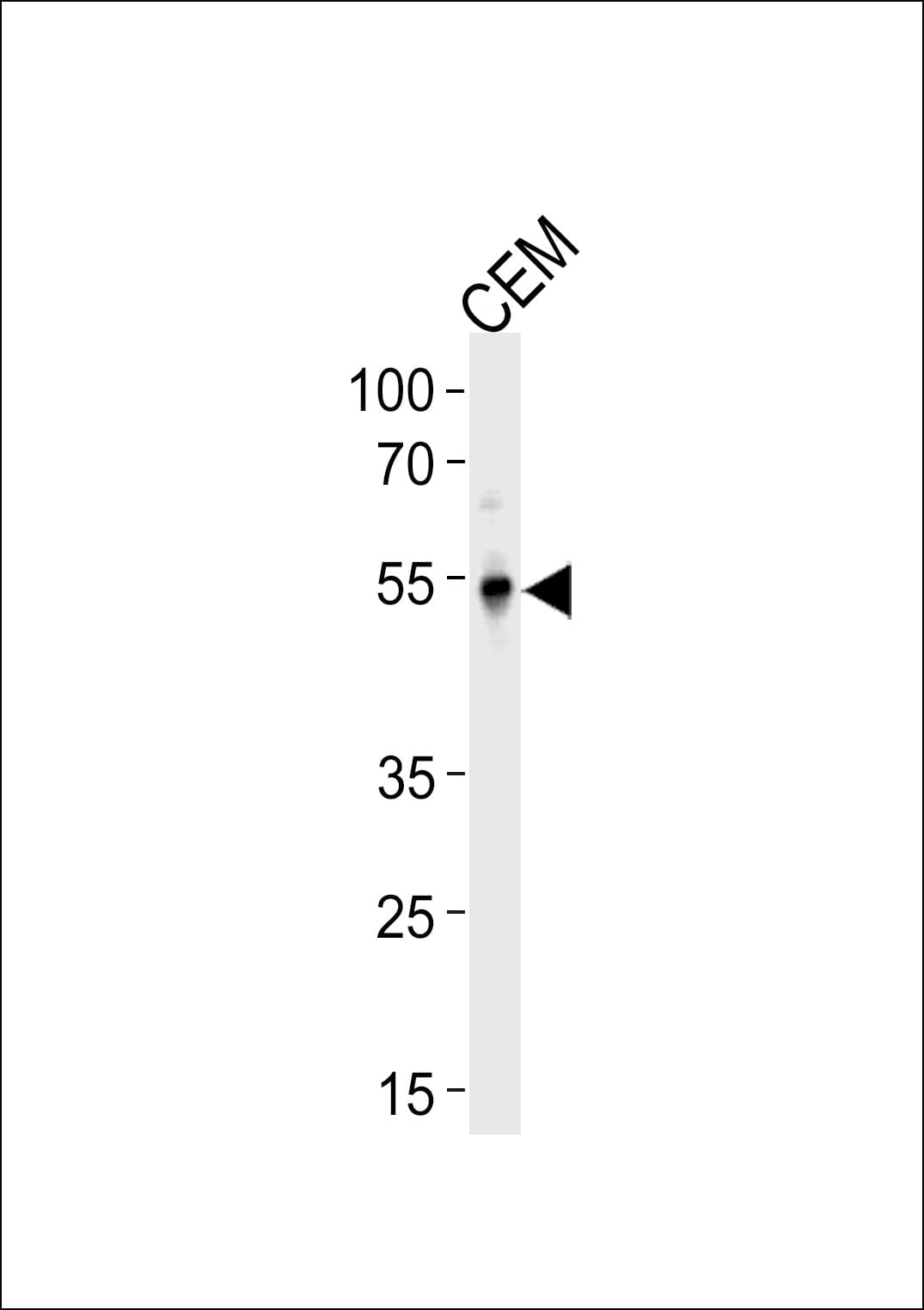 IHC-plus™ KLF5 / BTEB2 Antibody (aa341-370)