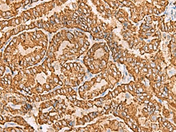 NPC2 Antibody