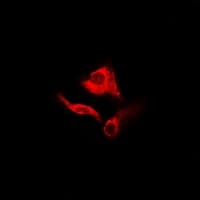 Polyclonal Rabbit anti-Human GDA / Nedasin Antibody (IF, WB)
