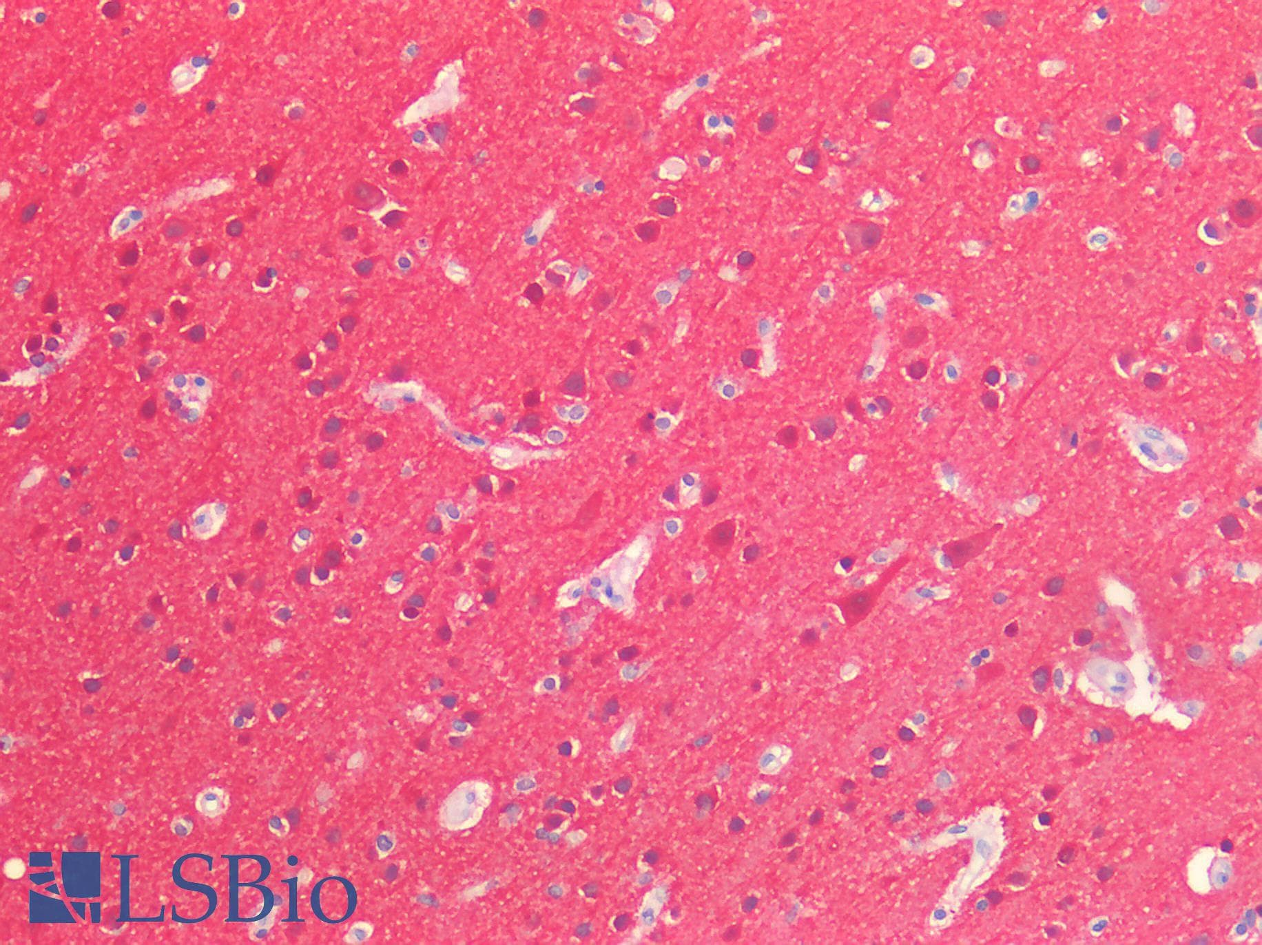 PathPlus™ UCHL1 / PGP9.5 Antibody