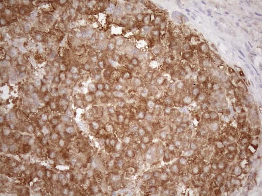 KRT16 / CK16 / Cytokeratin 16 Antibody (clone OTI1G1, Carrier-free)