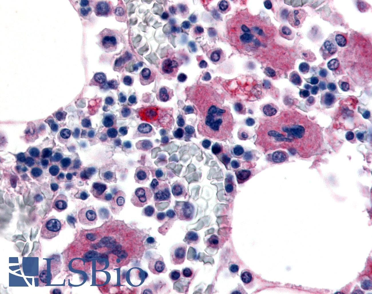 IHC-plus™ Polyclonal Rabbit anti-Human P2RY12 / P2Y12 Antibody (Extracellular Domain, IHC)