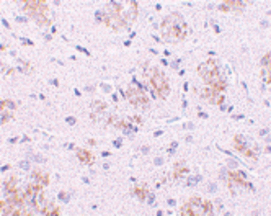 KLHL1 Antibody