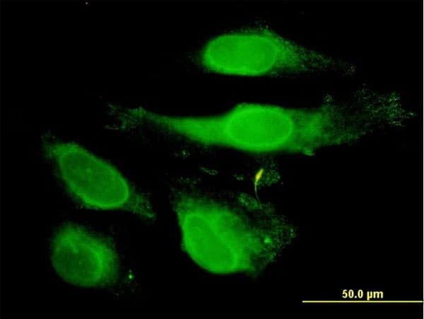 PRDX2 / Peroxiredoxin 2 Antibody (clone 4E10-2D2)