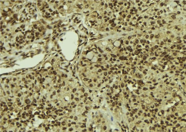 Polyclonal Rabbit anti-Human SART1 Antibody (IHC, WB)