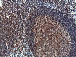 Monoclonal Mouse anti-Human PTP1B Antibody (clone OTI1C5, IHC, WB)