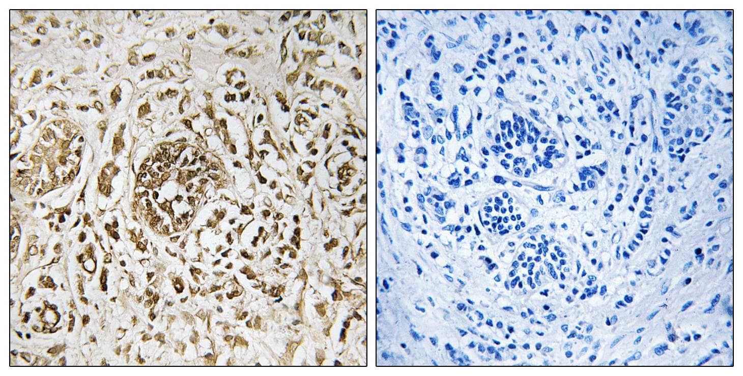 CIB2 / KIP2 Antibody
