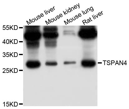 Polyclonal Rabbit anti-Human TSPAN4 Antibody (WB)
