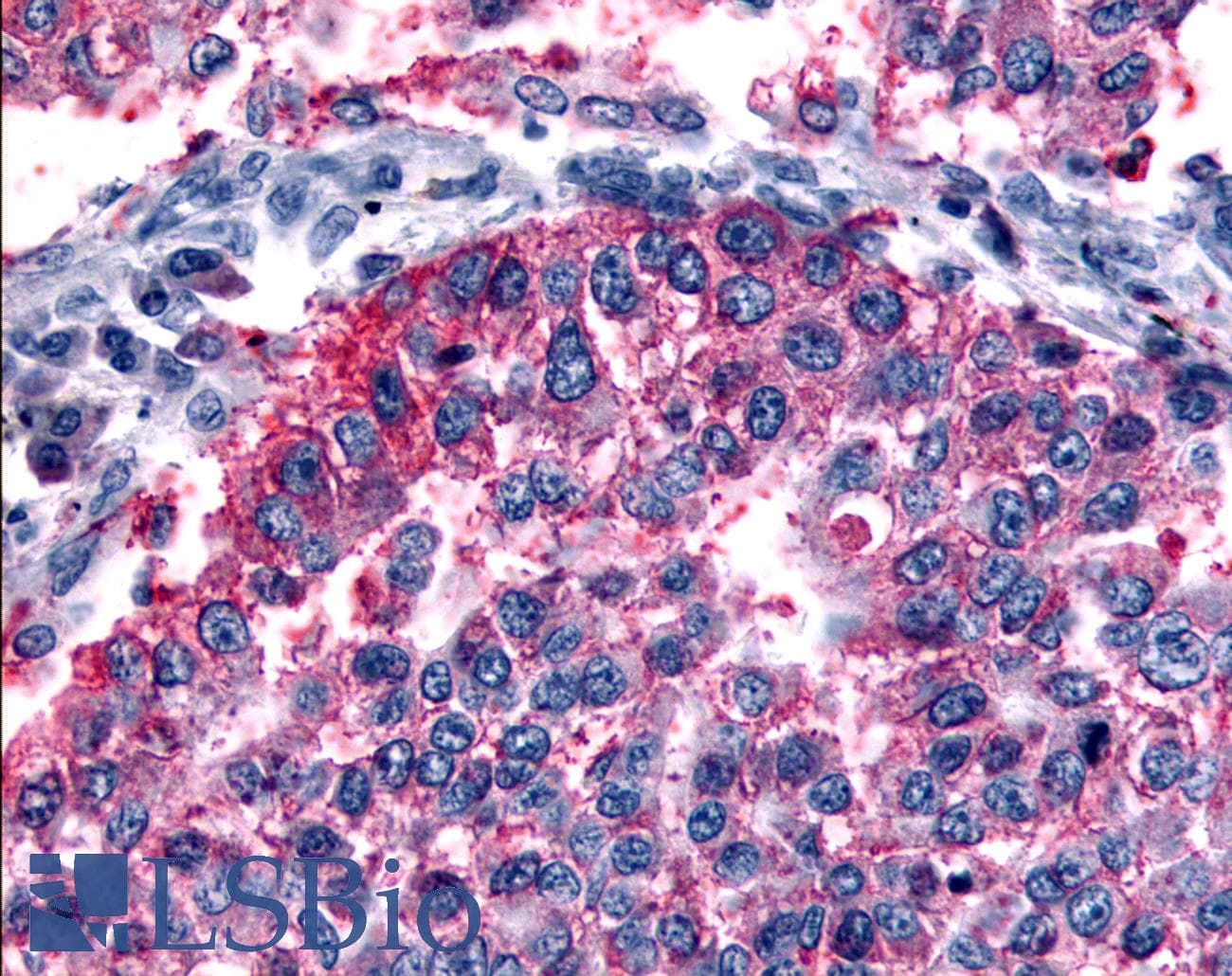 PathPlus™ GRM6 / MGLUR6 Antibody (N-Terminus)
