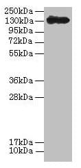 Crystal Protein cry1Ac Antibody