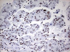 CD5 Antibody (clone OTI10F4)