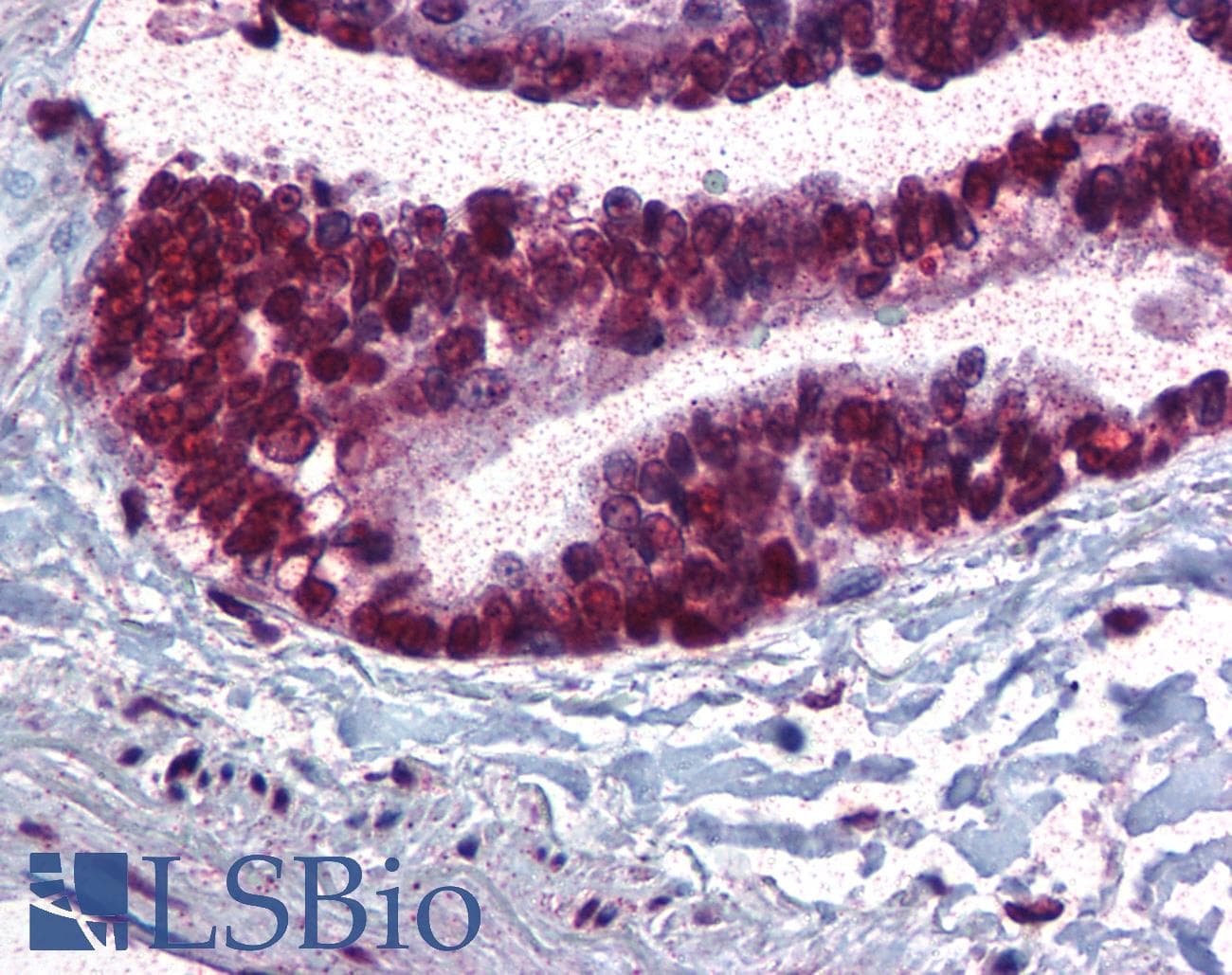 IHC-plus™ Polyclonal Rabbit anti-Human APC6 / CDC16 Antibody (phospho-Thr580, IHC, IF, WB)