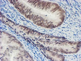 SENP2 Antibody (aa139-523, clone OTI3D3, Carrier-free)